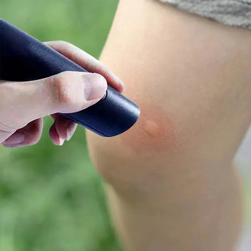 For itch, bite, insect, mosquito, portable pen, black, relieves adult children, physical anti-itch, anti-itch stick, anti-itch, anti-itch MedSurgery Store For Digital Health