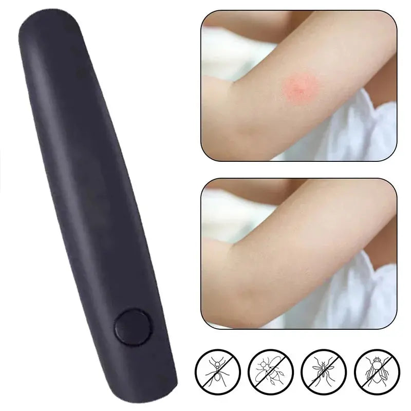 For itch, bite, insect, mosquito, portable pen, black, relieves adult children, physical anti-itch, anti-itch stick, anti-itch, anti-itch MedSurgery Store For Digital Health